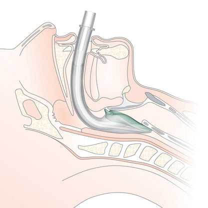 i-gel® supraglottische Atemhilfe